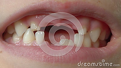 Macro di un ragazzino che mostra la bocca con i denti del latte mancanti. Concetto di cambiamento dei denti nel bambino archivi video Macro di un ragazzino che mostra la bocca con i denti del latte mancanti. Concetto di cambiamento dei denti nel bambino archivi video