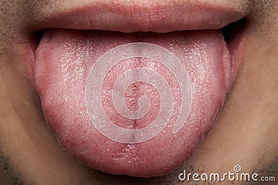 Macro of human tongue Stock Photo