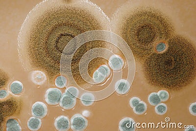 Macro mold colonies growing on an agar plates. Stock Photo