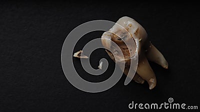 Macro shot of a decayed teeth till root after extraction of dentist Stock Photo