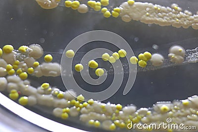 Macro view of bacteria and baker yeast colonies Stock Photo