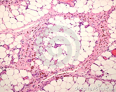 Macrophages. Peritoneal fat Stock Photo