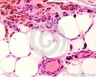 Macrophages. Peritoneal fat Stock Photo