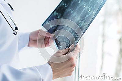 Magnetic resonance imaging in the doctor`s hands. Stock Photo