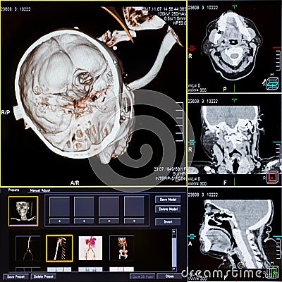 CT scans of human head Stock Photo