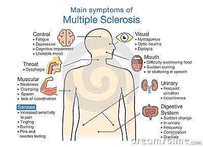 Main symptoms of Multiple Sclerosis. Vector Illustration