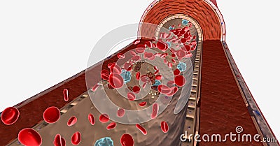 Malaria is a disease caused by a plasmodium parasite Stock Photo