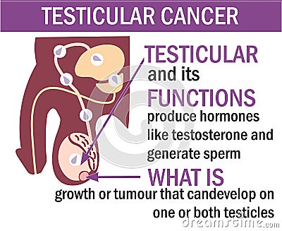 A Male anatomy of Testicular Cancer illustration. Testicular Cancer infographics. Vector Illustration