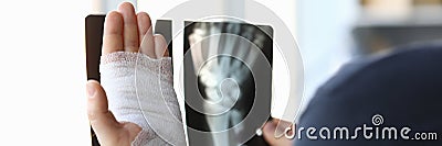 Male bandaged hand holds xray image closeup Stock Photo