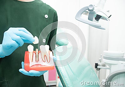 Male dentist carrying a sample of dental implants Stock Photo