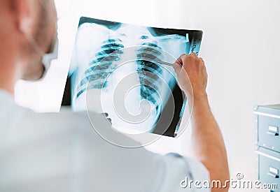 Male doctor examining the patient chest x-ray film lungs scan at radiology department in hospital.Covid-19 scan body xray test Stock Photo