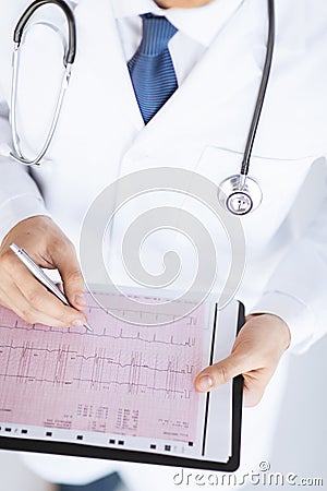 Male doctor hands with cardiogram Stock Photo