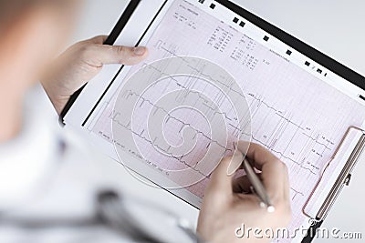 Male doctor hands with cardiogram Stock Photo