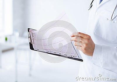 Male doctor hands holding cardiogram Stock Photo