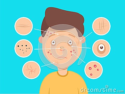 Male facial skin problems illustration. Acne and dark spots, wrinkles and circles under the eyes for cosmetics Cartoon Illustration