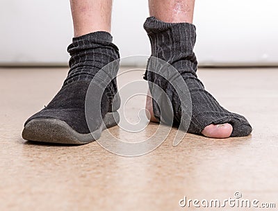 Male feet with sock in hole Stock Photo