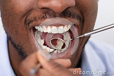 Male Patient Being Checked By Dentist Stock Photo