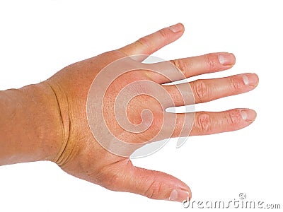 Male person showing swollen knuckles on white Stock Photo