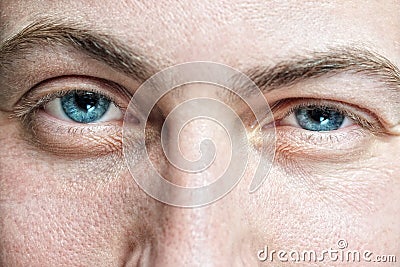 Male with problematic skin Stock Photo