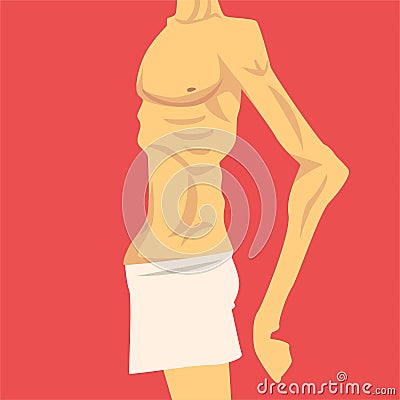 Male Torso with Short Weight and Sagging Belly, Human Body After Weight Loss, Side View, Obesity and Unhealthy Eating Vector Illustration