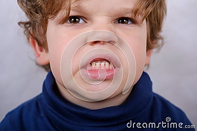 Malocclusion of the boy Stock Photo