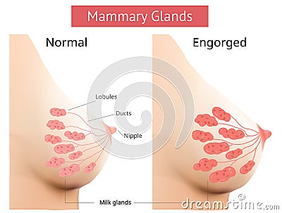 Mammary gland, Non-Lactating and Engorged breast, Female breast Anatomy, Vector Vector Illustration