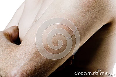 Man arm with nicotine patch Stock Photo