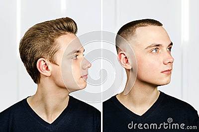 Man before arter haircut with hair loss: bald and pompadour, transplant and transformation in profile fade side Stock Photo