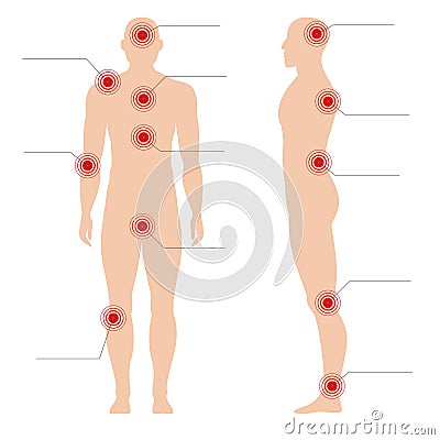 Man body with pain points. Circle painful red spot point on human silhouette vector medical abstract illustration Vector Illustration