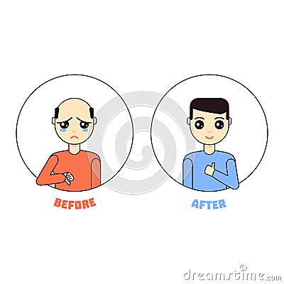 Man cartoon character before after alopecia treatment Vector Illustration