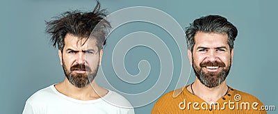 Man hair loss and problem hair. Hairs problems. Sad and happy. Haircare and loss hair problem. Tangling hairs. Combing Stock Photo