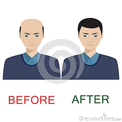 Man before and after hair treatment. Vector Illustration