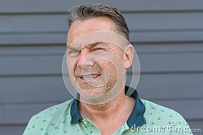 Man with an inflamed eye and conjunctivitis Stock Photo