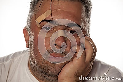 Man with injured face Stock Photo