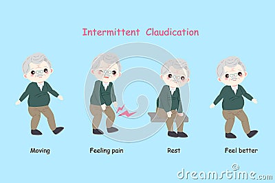 Man with intermittent claudication Stock Photo