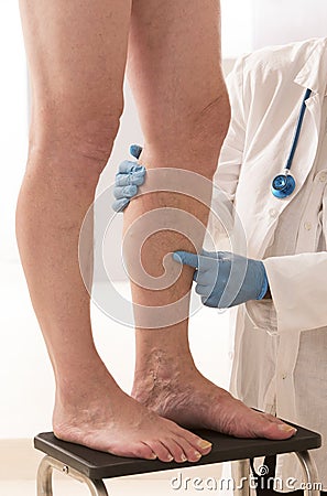 Man Lower limb vascular examination by phlebologist Stock Photo