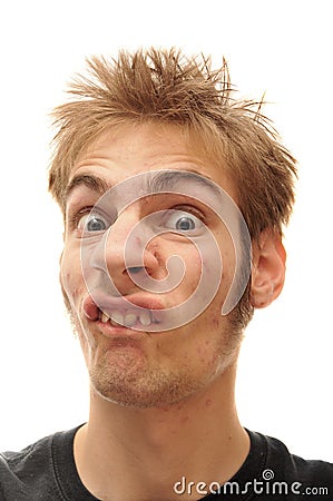 Man making strange face with crooked teeth Stock Photo