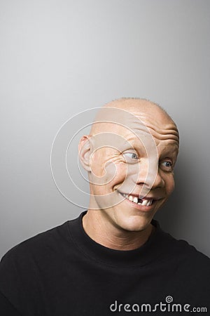 Man with missing tooth. Stock Photo