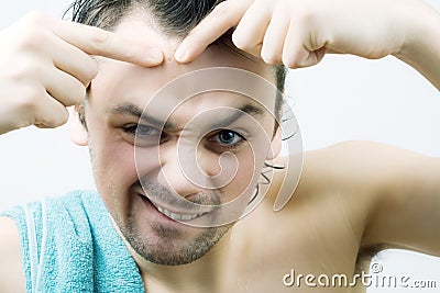 Man picking pimple. Stock Photo