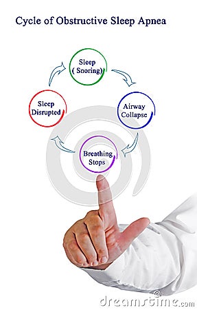 Cycle of Obstructive Sleep Apnea Stock Photo