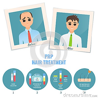 Man before and after PRP treatment Vector Illustration