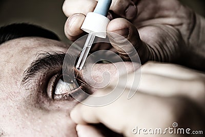 Man is putting drops in his eyes. Medical treatment concept. Allergic conjunctivitis problem Stock Photo