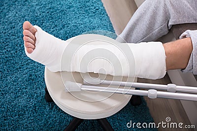 Man`s Broken Leg Stock Photo