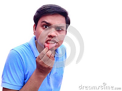 Man suffer from mouth ulcer on lips also known as aphthae painfull feeling Stock Photo