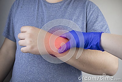 A man suffers from elbow pain. Damaged elbow joint, bone fracture, or sprain. Hand injury and flexion pain concept Stock Photo