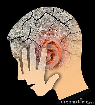 Man touching her painful head and ear, symbolizing tinnitus and ear problems. Stock Photo