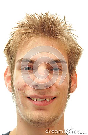 Man trying to smile with crooked teeth Stock Photo