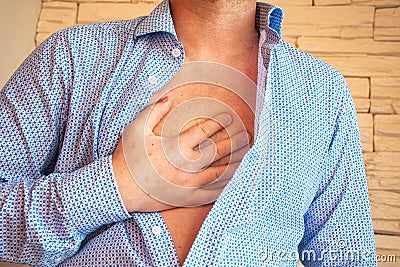 Man unbuttoned his shirt on his chest and placed his hand on sternum area because of severe pain behind his sternum or chest. Conc Stock Photo