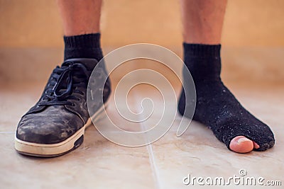 Man wearing holey sock and dirty shoes. Poorness and untidiness concept Stock Photo