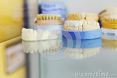 Manufacturing of ceramic prostheses. Restoration of lost teeth in a dental clinic Stock Photo